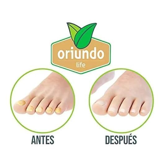 Oriundo Nail Fungus Away Treatment – Anti-Fungal Nail Solution